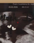 Personalisierter Bilderrahmen mit Ultraschallbild – „Wetsch du mis Gotti / Götti si?“